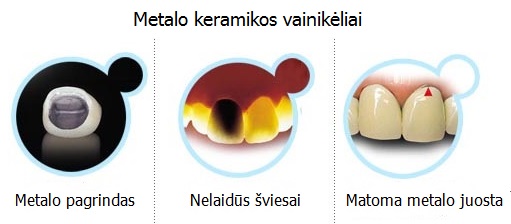 Tvirtas cirkonio oksido karkasas dantų protezams